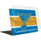 NHL St. Louis Blues Jersey MacBook Air 15in (2023-2025) Case plus Skin